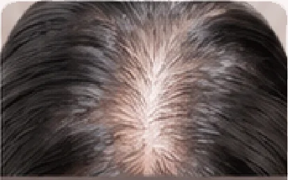 Owner's crown: before