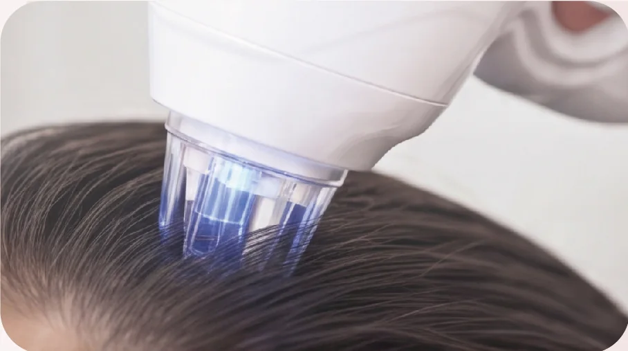 Efficient delivery: non-invasive nano electroporation