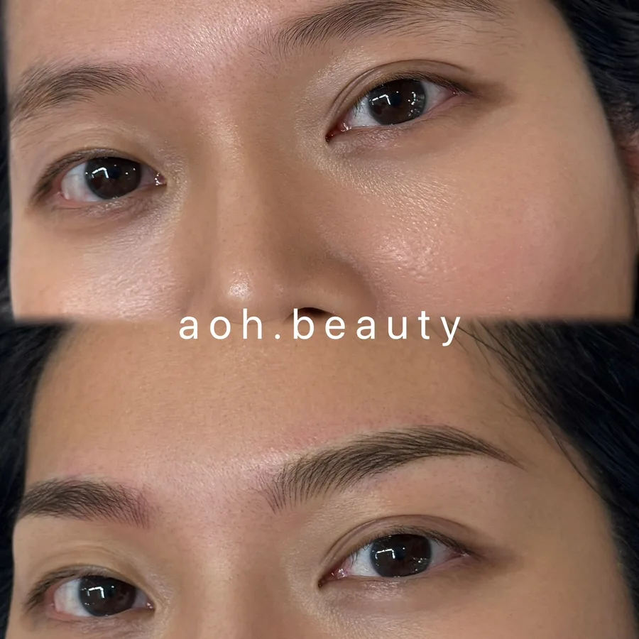 Hairstroke brows · before and after: real case, before, after and detail