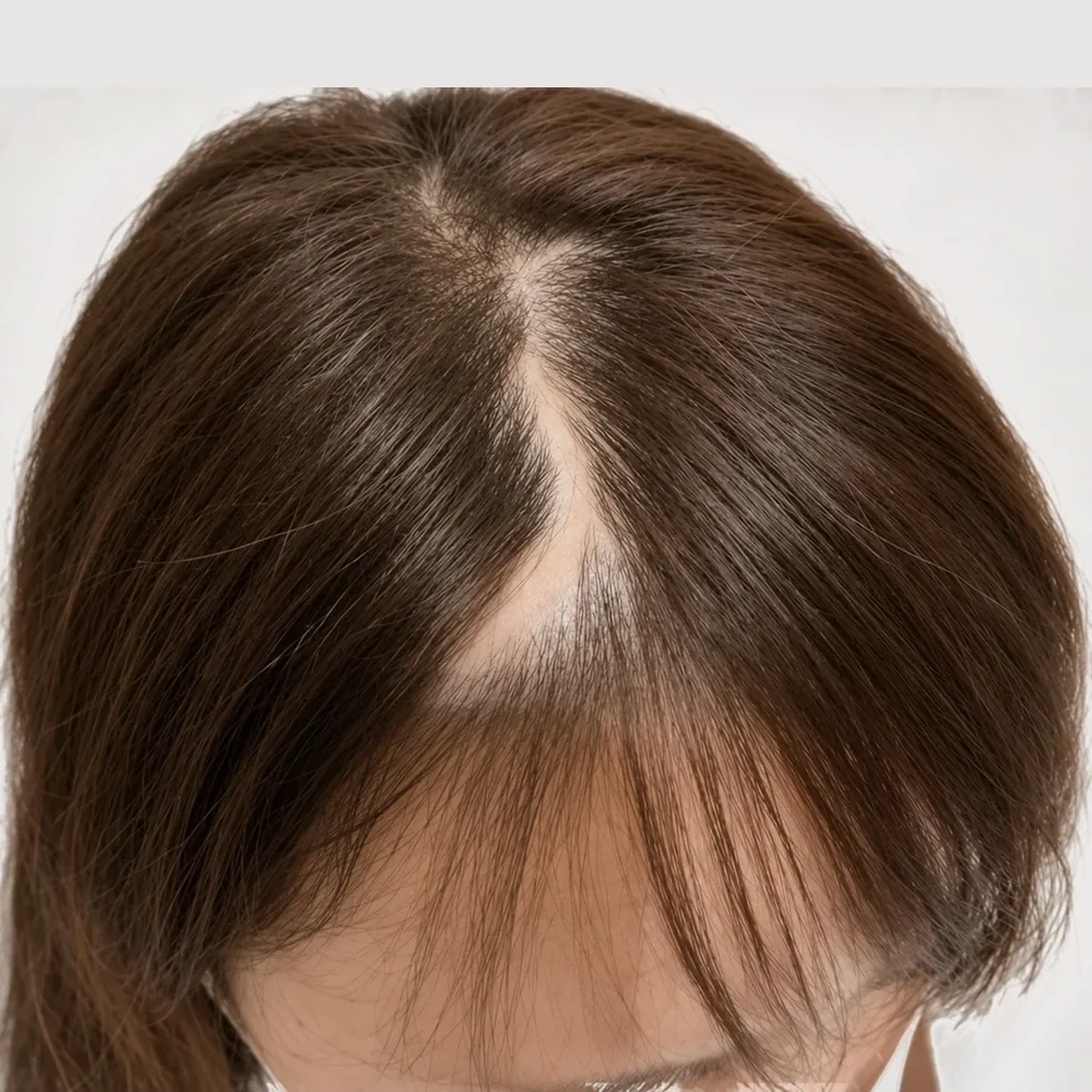 Scar camouflage · before