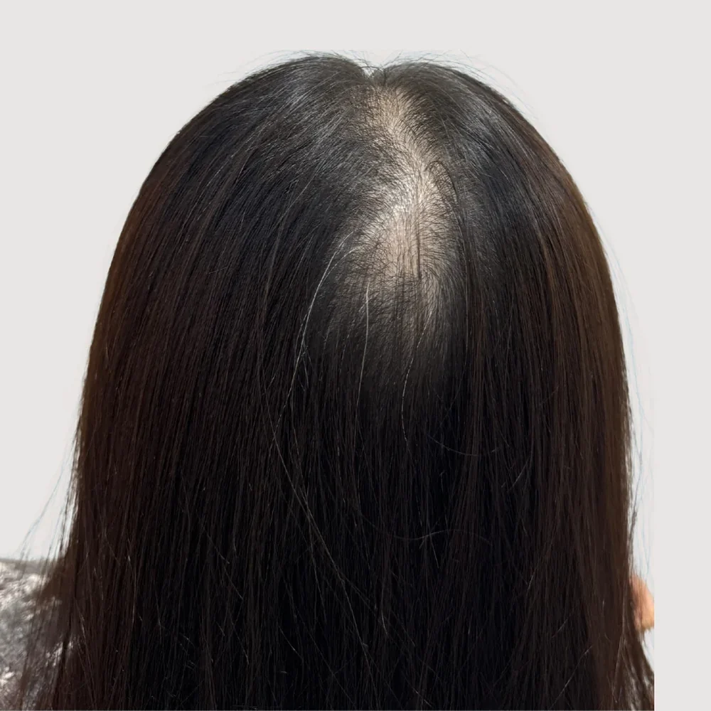 Women's crown · before