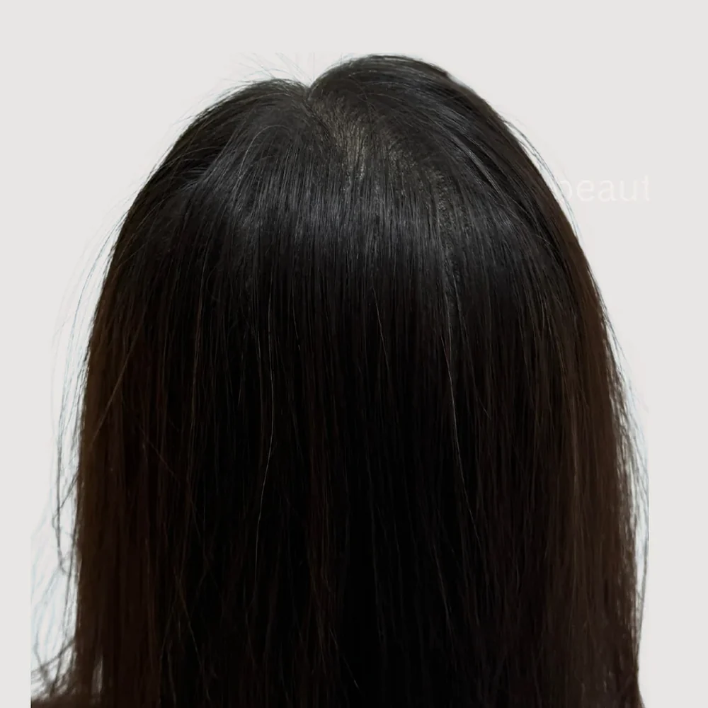 Women's crown · after
