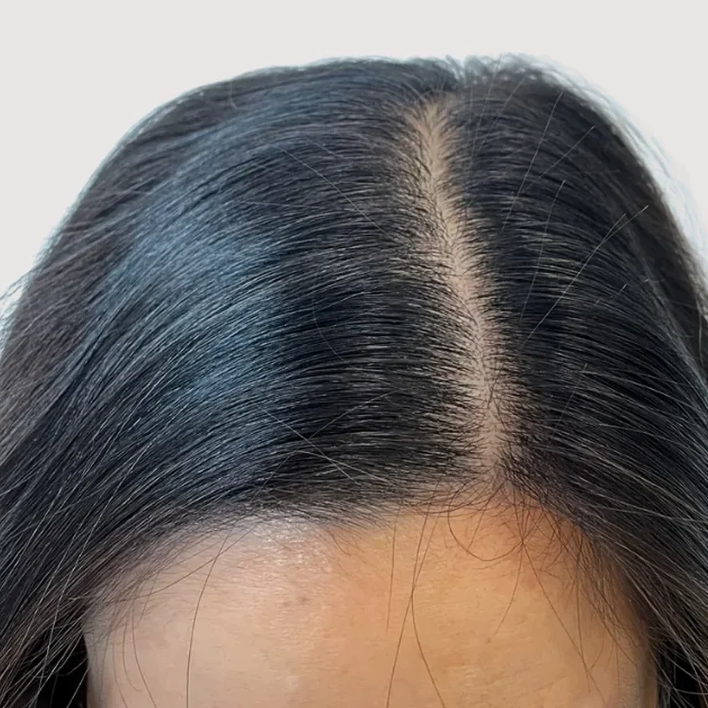 Women's parting · 3 sessions · before
