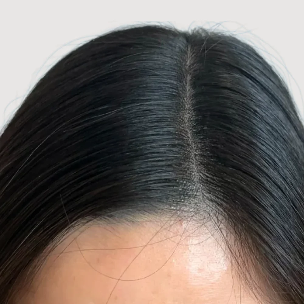 Women's parting · 3 sessions · after