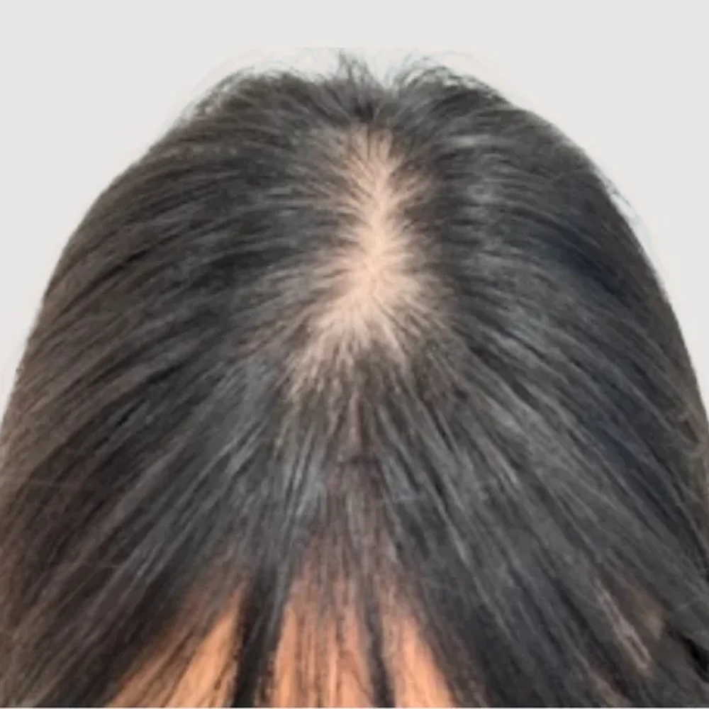 Women's parting · hairline · case 3 · before
