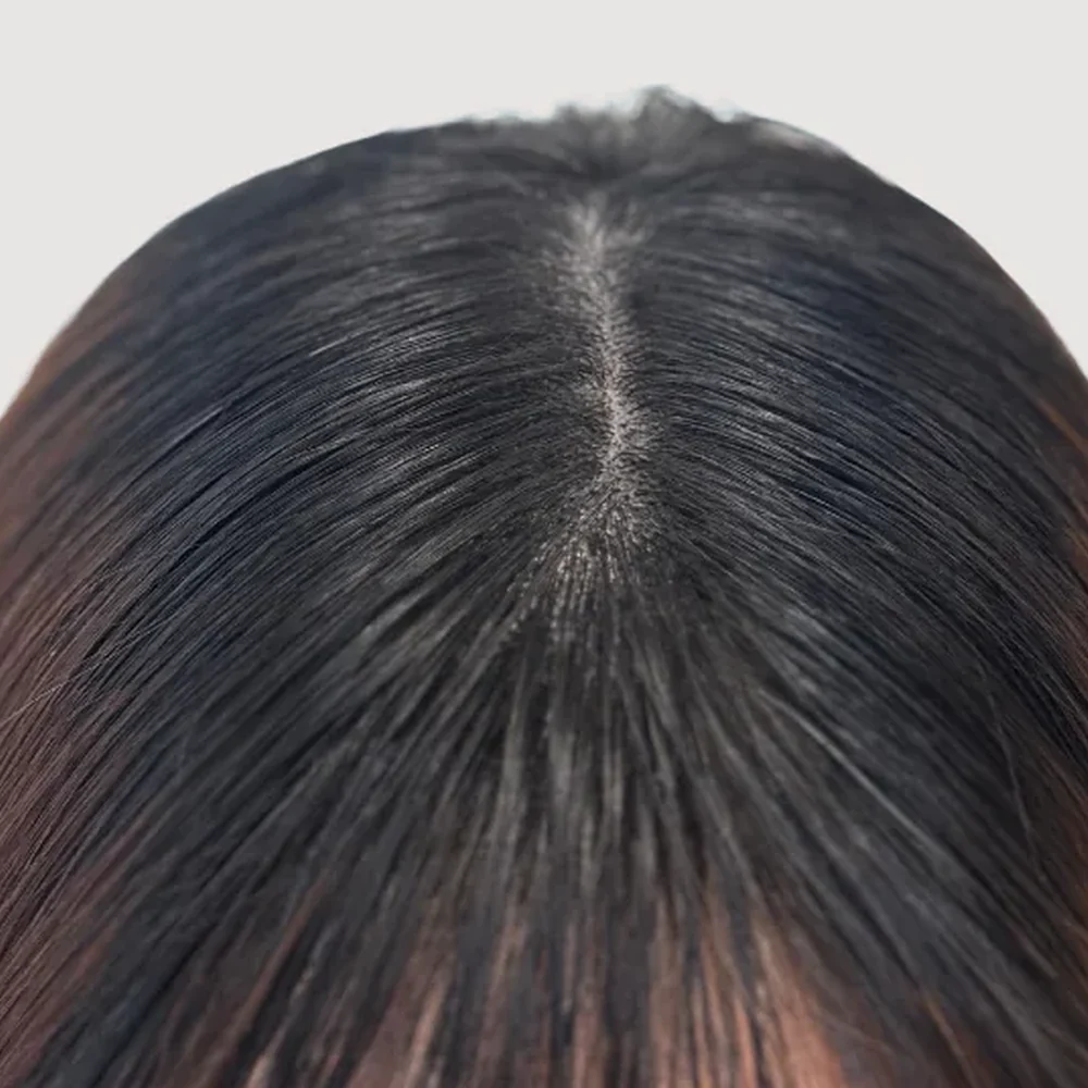 Women's parting · hairline · case 3 · after