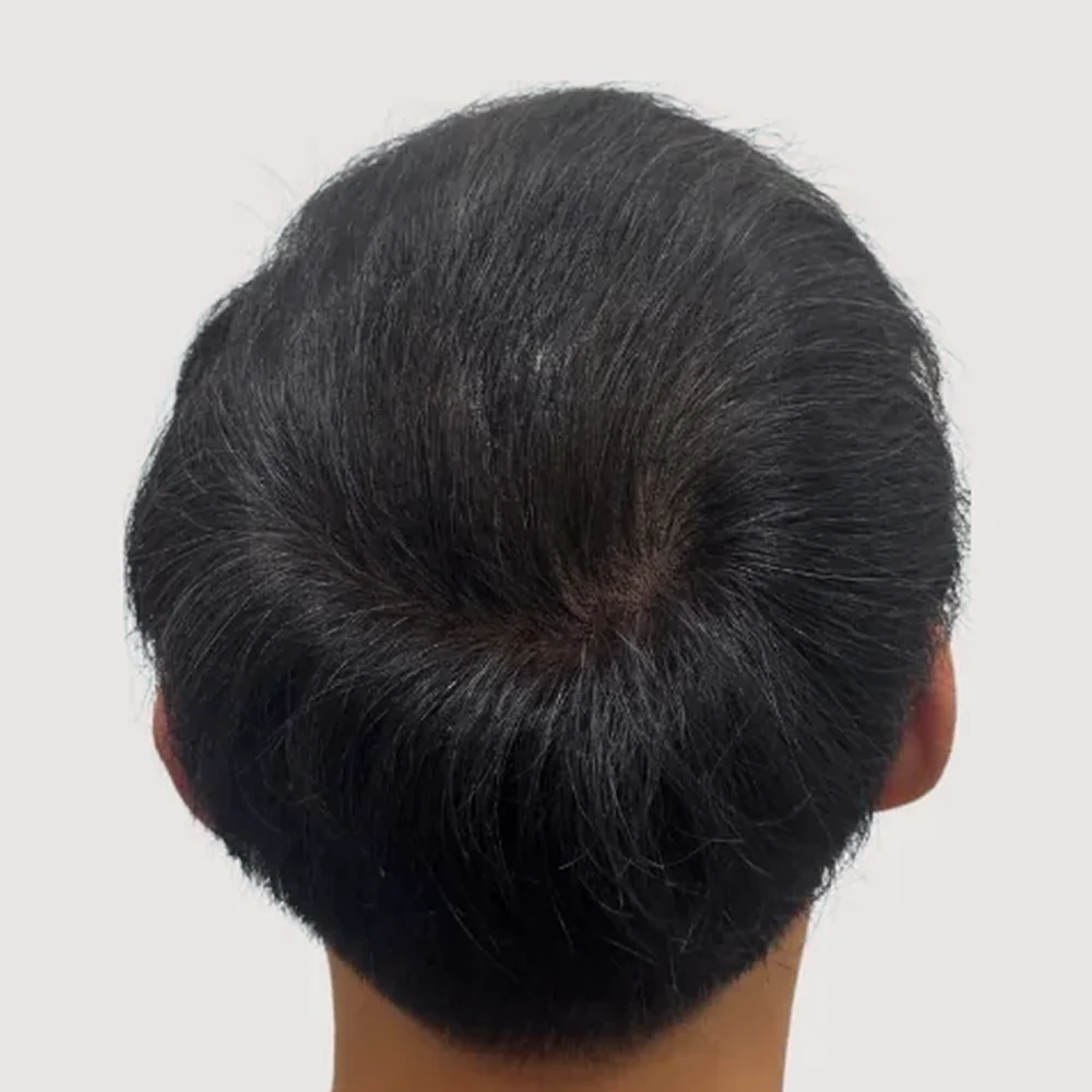 Men's crown · 3 sessions · after