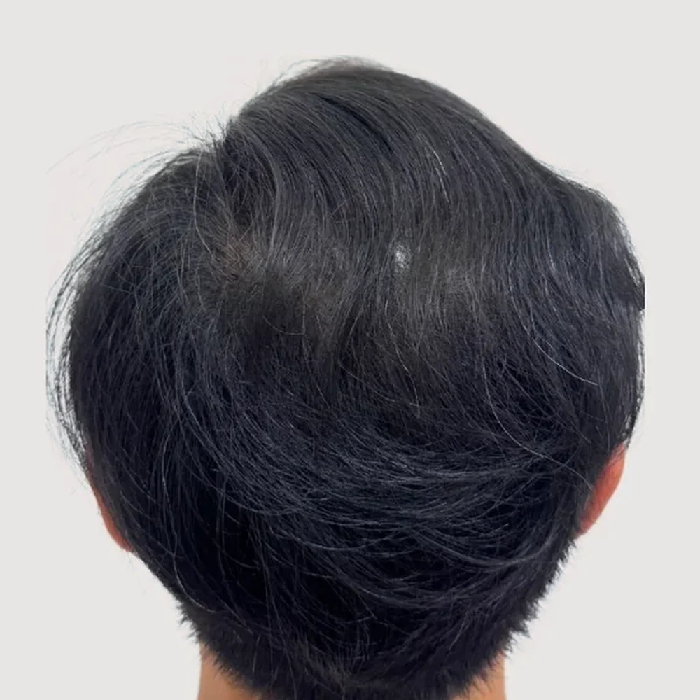 Men's crown · after