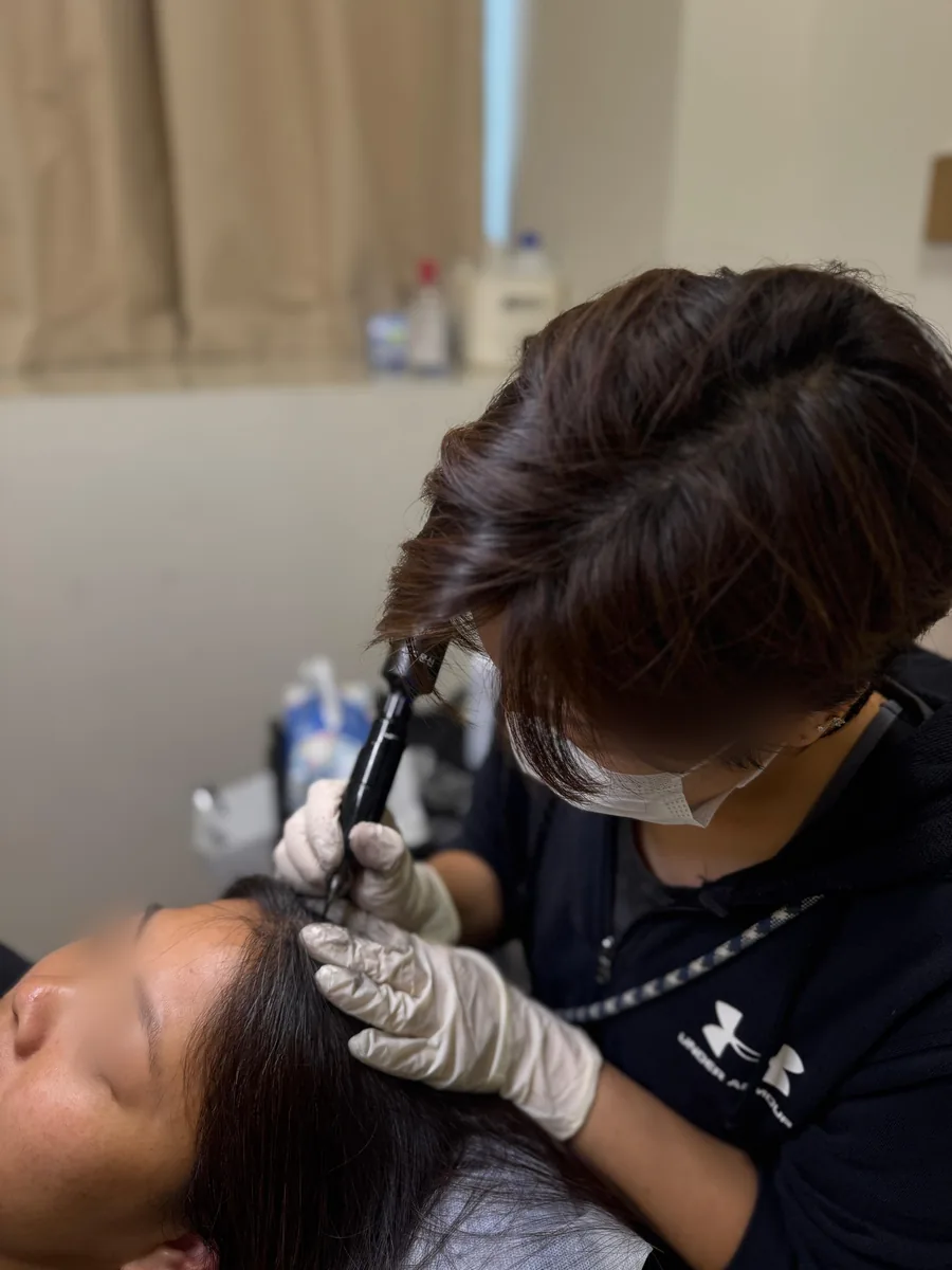 A student needling the scalp