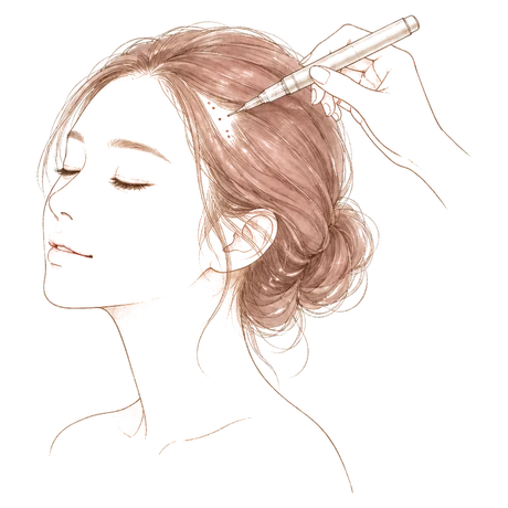 Illustration: first session, base layer