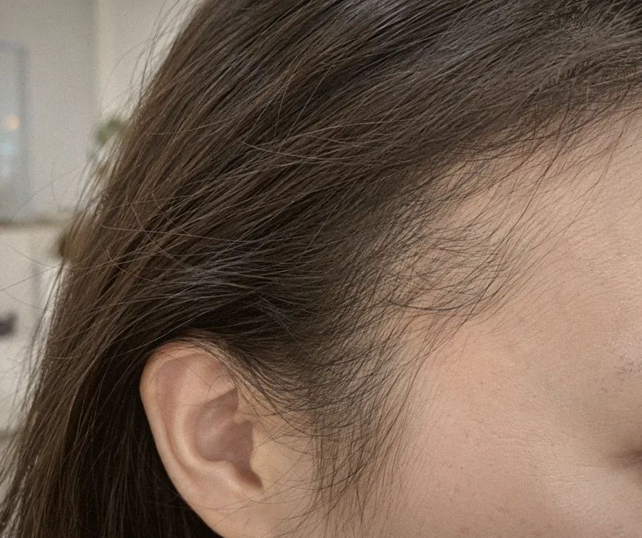 Photo guide: sides, shoot both left and right